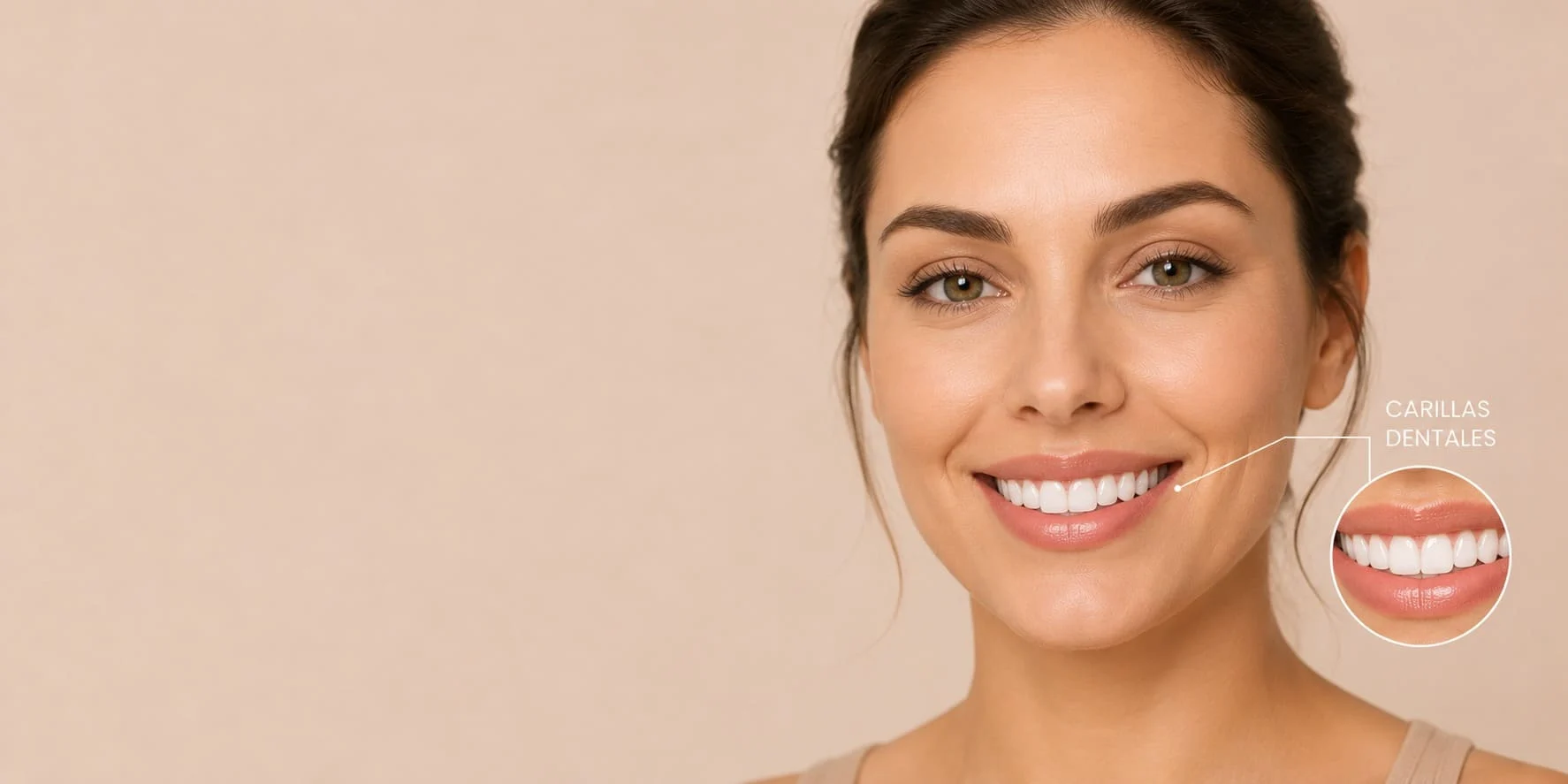 dental-y-sonrisa-carillas-dentales
