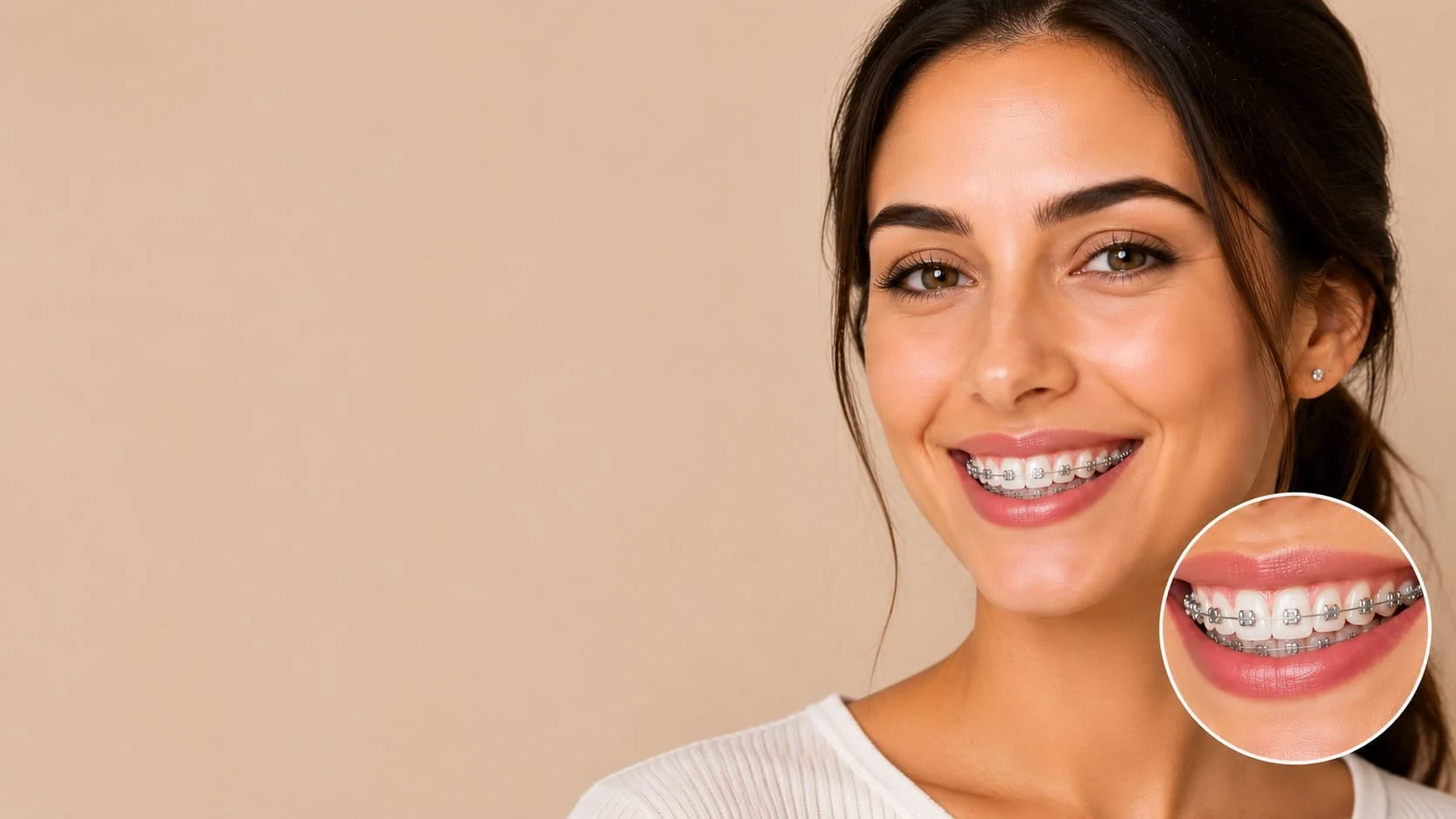 dental-y-sonrisa-ortodoncia-brackets