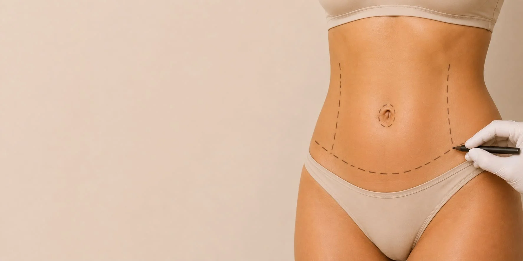 intervenciones-quirurgicas-abdominoplastia