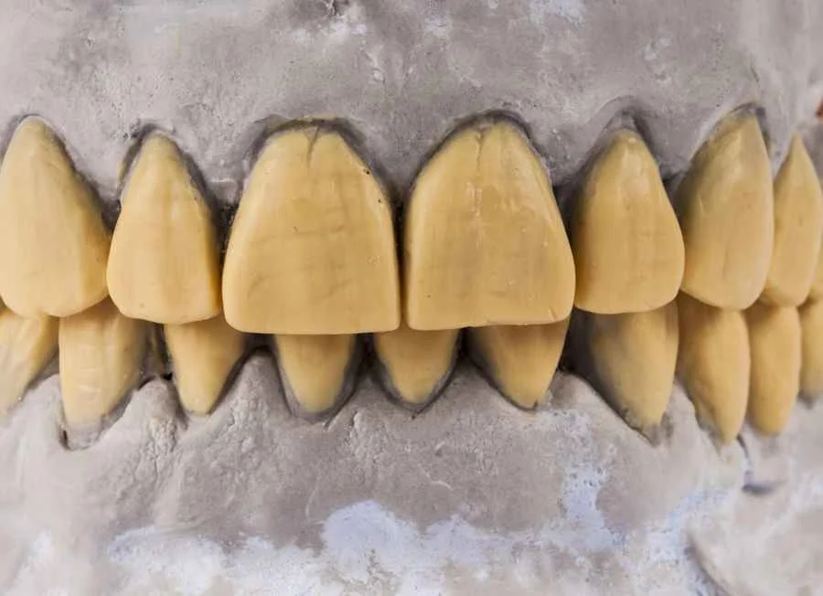 dientes-amarillos
