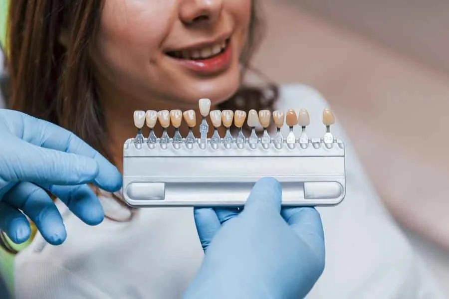 dientes-oscuros