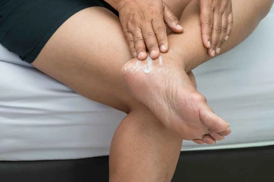 piernas hinchadas