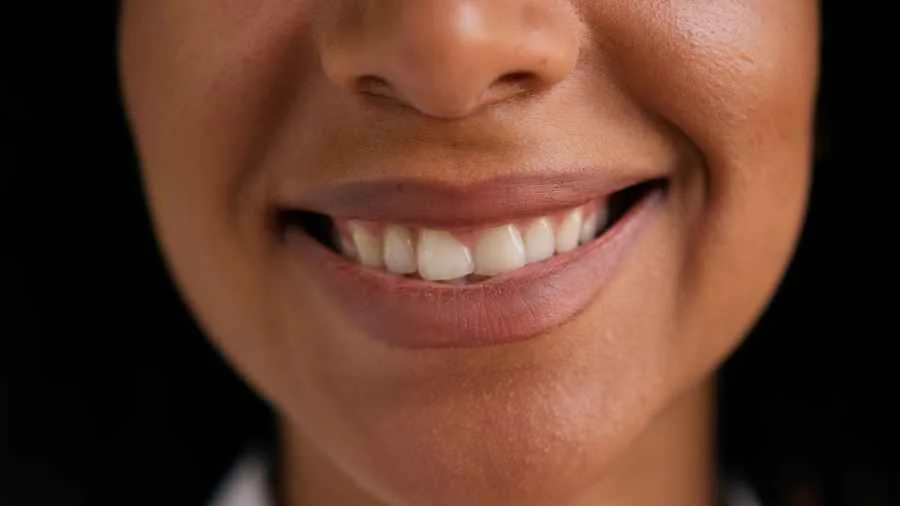 sonrisa-desproporcionada